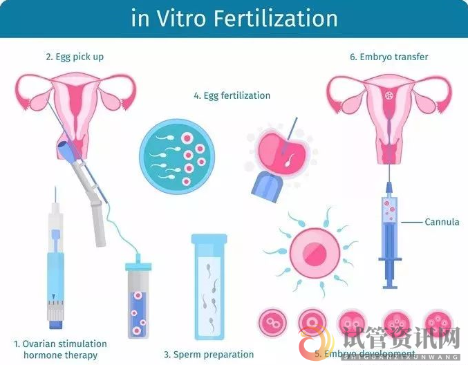 做试管婴儿一个周期大概需要多久(图1)