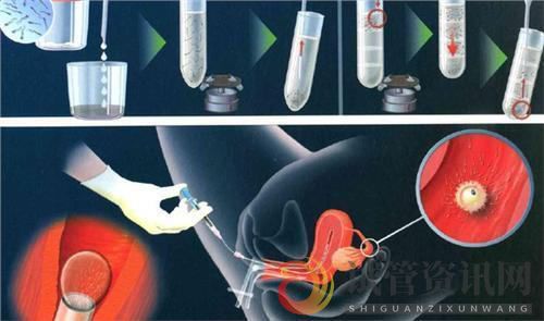 做试管期间可以喝蜂蜜水吗移植后不能喝蜂蜜水吗(图1)