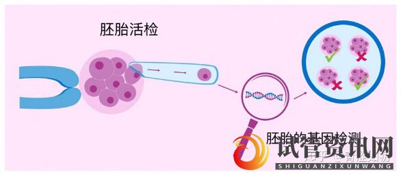 试管婴儿的利弊分析(图1)