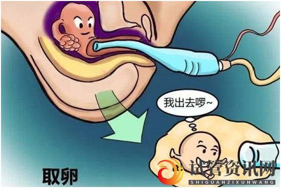 很多人都忽略了大龄做试管婴儿的这些好处(图1)