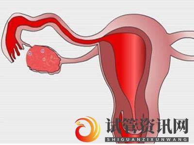 成都子宫肌瘤做俄罗斯试管婴儿的成功率高吗？(图2)