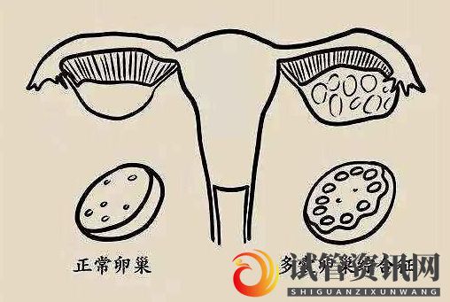 成都多囊促排怀孕成功率大吗？(图1)