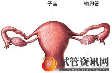 成都多囊患者做试管婴儿,会降低成功率吗(图1)