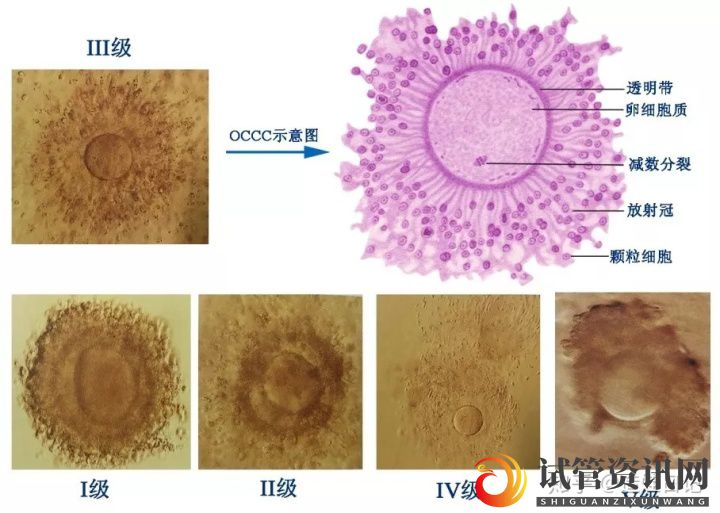 成都年龄大做试管成功率为什么低(图3)