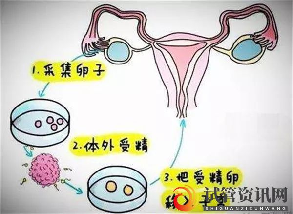 成都人工授精与试管婴儿的三大区别_知乎_(图1)