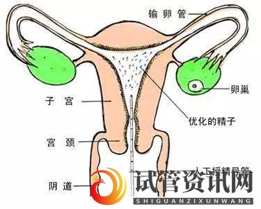 成都什么叫人工授精(图1)