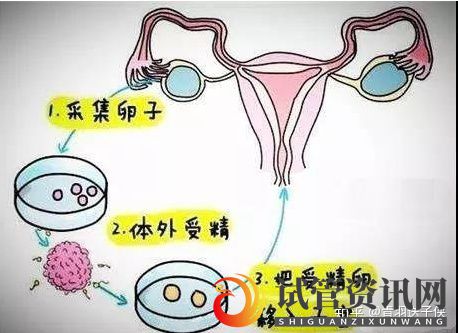 成都试管婴儿和人工授精有区别哪个成功率高(图5)