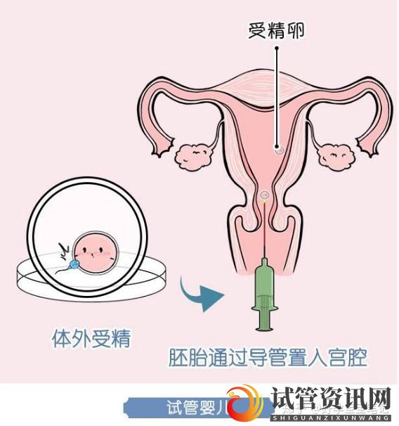 成都人工授精和试管婴儿适应症、费用、成功率的对比(图5)