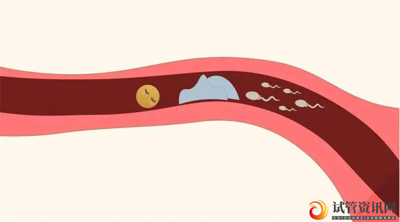 成都输卵管通而不畅，还可以自己怀上吗？(图1)