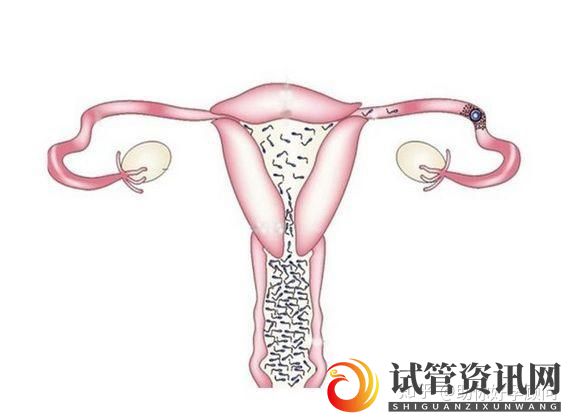 成都“三招”评估自己的试管婴儿成功率(图3)