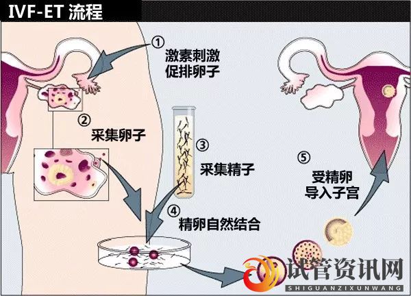 第3代试管婴儿到底能诊断哪些遗传性疾病？(图3)