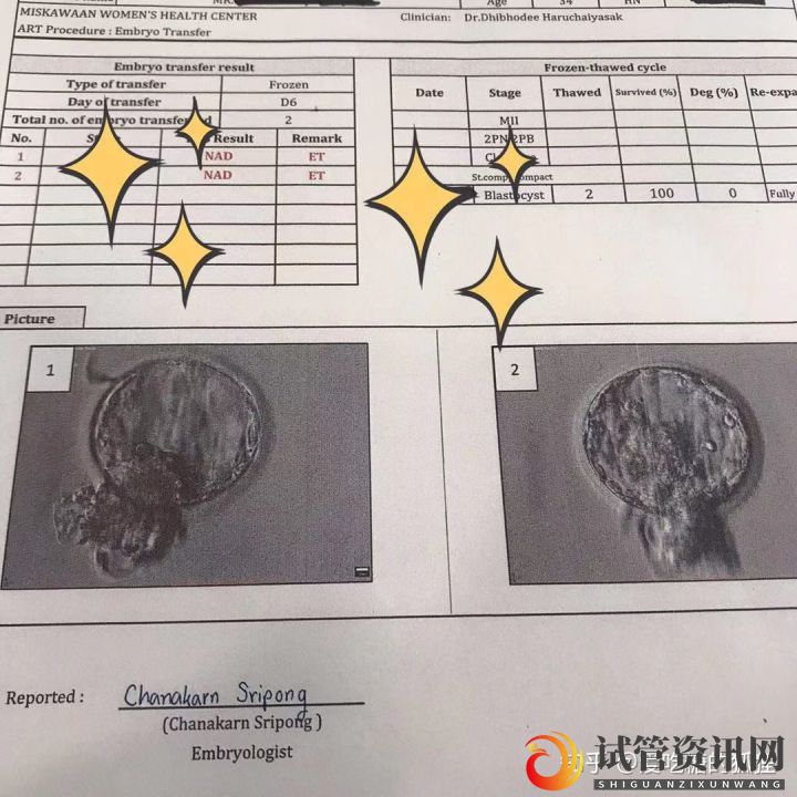 我老公的无精症给治好了!龙凤胎宝宝已经在腹中安稳(图7)