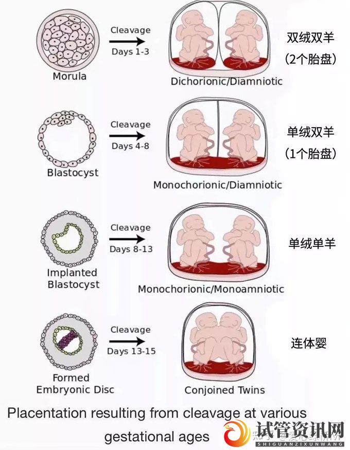 试管双胞胎是单绒还是双绒(图2)