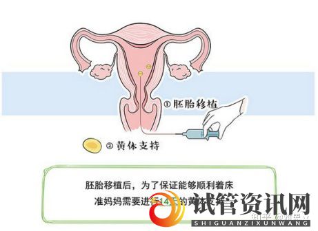 女人做试管过程痛苦吗(图5)