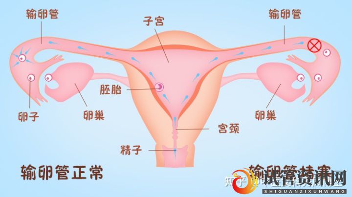 女性不孕不育的5大原因,来了解一下(图3)