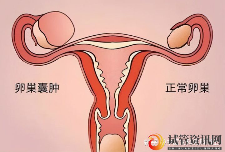 女性不孕不育的5大原因,来了解一下(图4)