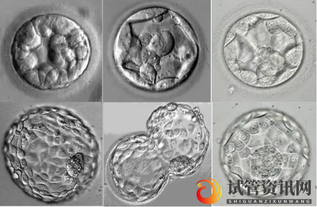 试管囊胚划分标准
