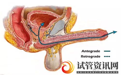 憋精不射,精液去哪了_对身体有害吗(图4)