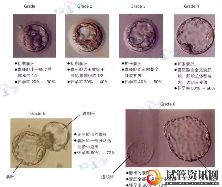 试管婴儿要不要养囊_先教你三招提高卵子质量(图3)