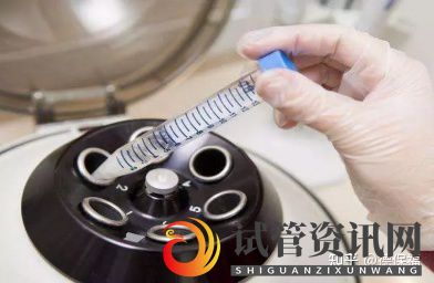 什么是HIV洗精术,HIV洗精术的作用是什么(图1)