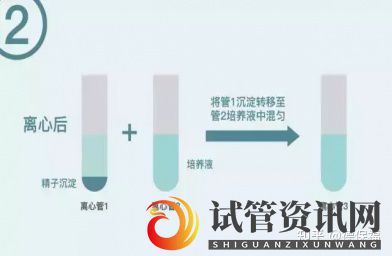 什么是HIV洗精术,HIV洗精术的作用是什么(图5)