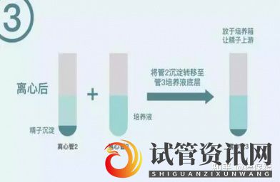 什么是HIV洗精术,HIV洗精术的作用是什么(图6)