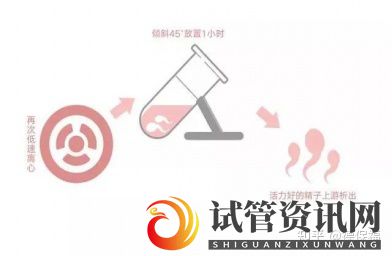 什么是HIV洗精术,HIV洗精术的作用是什么(图7)