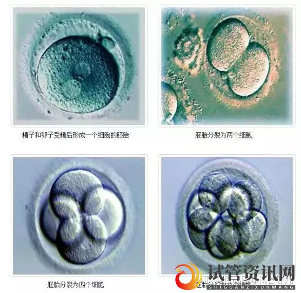 什么是试管养囊_听说养囊成功率高,我也可以养吗(图3)