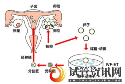 试管适应症_第一代试管婴儿(图3)