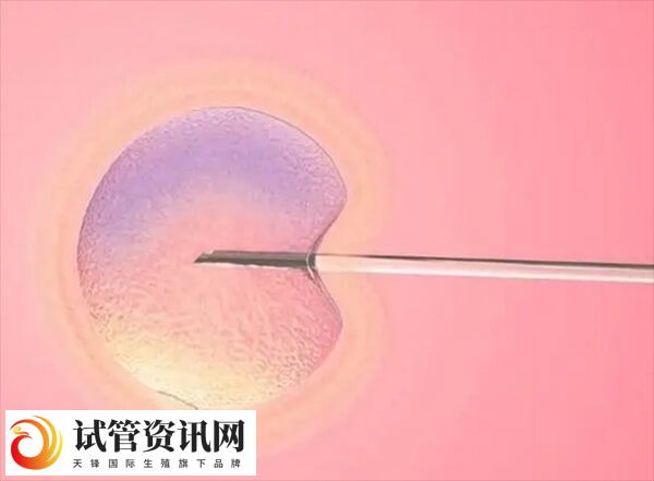 取卵同时穿刺囊肿可能引起感染