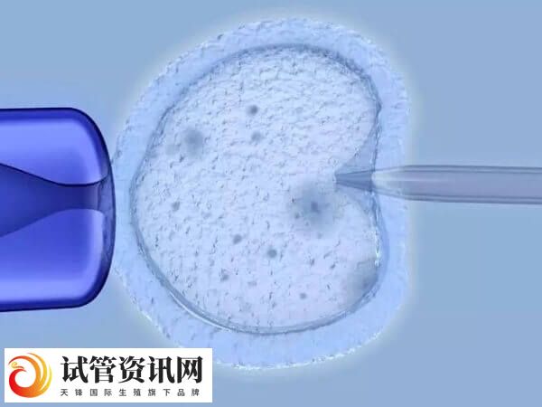 超长方案的优点是成功率高